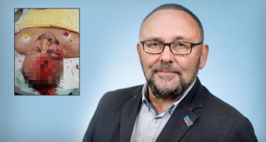 Во Германија претепан пратеник-популист