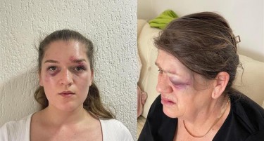 Скопјанка објави фотографии откако насилен сосед ја претепа заедно со мајка и