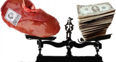 Беспарицата ги тера турските граѓани да си ги продаваат бубрезите