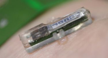 Бежичен имплант може да открие срцев удар неколку часа порано