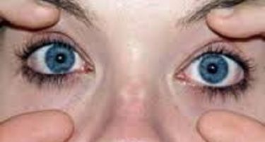 Што претставува Офталмоплегија – Мрзливо око?