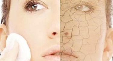 Сиптоми и превенција за сува кожа