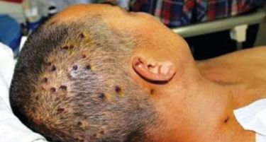 (ВИДЕО) СТРШЛЕНИ-УБИЈЦИ: Погледнете ги убодите од овие чудовишта!