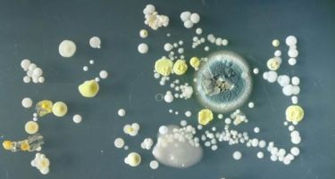 МИЛИОН БАКТЕРИИ НА ВАШИОТ МОБИЛЕН: Се закануваат сериозни зарази, еве поради која бактерија!