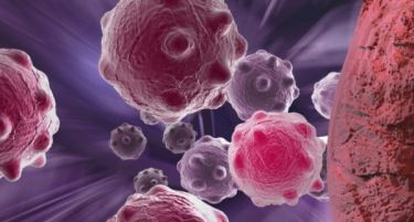 Истражување: Хемотерапијата не може да го излечи ракот?