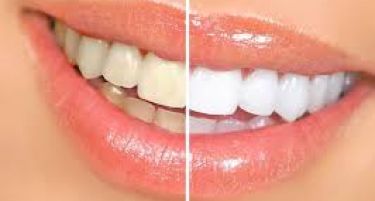Неколку трикови за бели заби