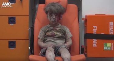 (ВИДЕО-ФОТО 18+) Страдање на невини и ужасот на Алепо во една фотографија-Русија ли е виновна?