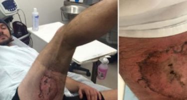 (ВИДЕО-ФОТО) „iPhone“ му експлодирал на Британец во џеб