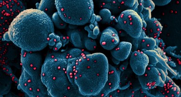 (ФОТО) Короната под микроскоп: Како навистина изгледа „невидливиот“ непријател