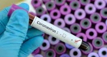 Фондот за здравство ги намалува цените на тестовите за корона вирусот