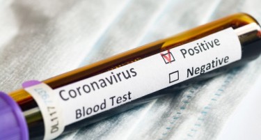 Македонија сега има помалку од 18.000 активни случаи на коронавирусот