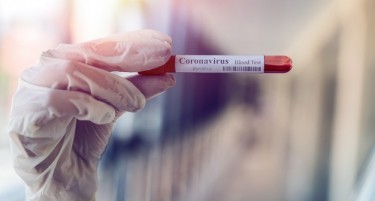 Триесет починати и 447 заразени со коронавирусот
