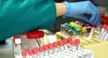 ВО МАКЕДОНИЈА УШТЕ 801 АКТИВНИ СЛУЧАИ: Денеска 133 нови случаи на ковид, има еден починат пациент