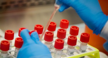 ГОЛЕМ РАСТ НА БРОЈОТ НА НОВОЗАРАЗЕНИ: Последните 24 часа регистрирани 293 нови случаи