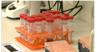 СКАПИТЕ АНАЛИЗИ НЕ СЕ ЗА ОБИЧНИОТ ПЕНЗИОНЕР, СИ ЧЕКАМЕ СО МЕСЕЦИ ДА СЕ ПРЕГЛЕДАМЕ НА „ДРЖАВНО“: Нема термини за пнеумослајд, хелико бактер, урино култура