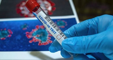 НОВИ 679 ЗАБОЛЕНИ СО КОВИД-19 ИЗМИНАТИТЕ 24 ЧАСА, нема починати лица