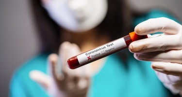 Регистрирани се 693 случаи на КОВИД-19 и двајца починати