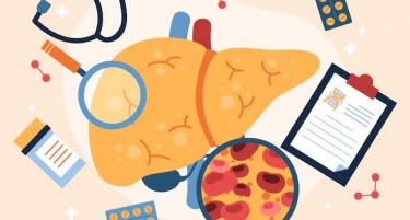 Практични здравствени совети за помош при замастување на црниот дроб