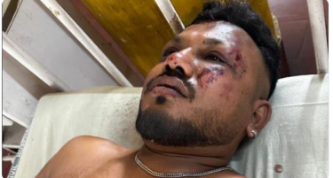 (ВИДЕО) ЕДЕН ПАТНИК ЈА ПРЕЖИВЕА АВИОНСКАТА НЕСРЕЌА ВО ИНДИЈА: Насекаде имало тела, станал и почнал да бега