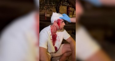 ВИДЕО Протести во Србија: Поддржувачи на Вучиќ претепаа пратеник од опозицијата