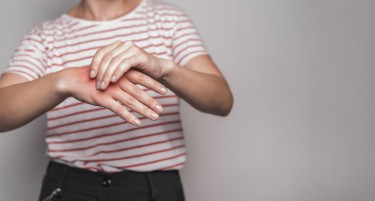 ПРИРОДНО РЕШЕНИЕ: Еве како да ја негувате кожата и зглобовите