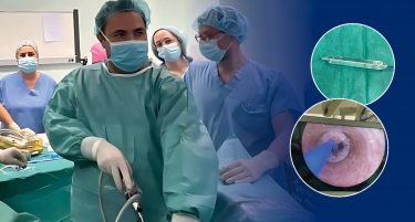 ВО „АЏИБАДЕМ СИСТИНА“ УСПЕШНО ИЗВЕДЕНИ ДВЕ МИНИМАЛНО ИНВАЗИВНИ ПРОЦЕДУРИ СО УПОТРЕБА НА ХЕМИСКИ ОБЛОЖЕН БАЛОН ВО ТРЕТМАН НА ПОВТОРУВАЧКИ ЦВРСТИ СТЕСНУВАЊА (СТРИКТУРИ) НА МОЧНИОТ КАНАЛ